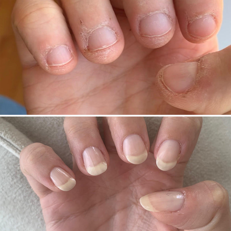 Strengthen your nails