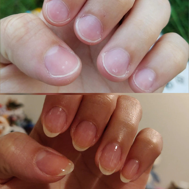 Moisturize & protect